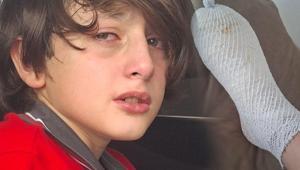 Ödül olarak alınan oyuncak elinde patladı 11 yaşındaki Furkan 2nci derece yandı