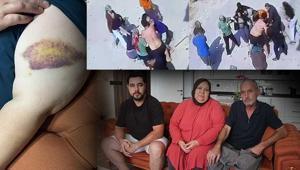 Zincir, keser, sopa ve bıçak... İki ailenin meydan savaşı: Mangal yapıp bize gıcıklık veriyorlar