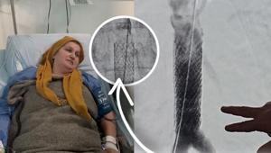 Milyonda bir görülen vaka Öksürürken kalp damarı yırtılan kadın ölümden döndü