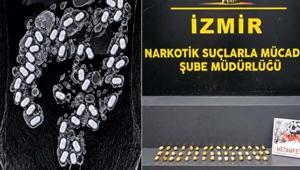 Havalimanı polisinin dikkatinden kaçamadı Midesinde uyuşturucu taşıyan yolcu böyle yakalandı