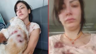 Genç kadın kan içinde kaldı! 'Bacağımın arkasını parçaladılar'