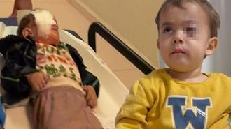Bursa'da torpil felaketi! 2 yaşındaki çocuğu kör etti: '1 hafta önce satmasın diye yalvarmıştım'