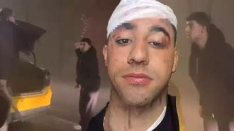 İstanbul'da taksici dehşeti! 'Sopayla kafama 10 defa vurdu'