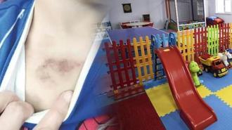 İBB kreşinde istismar ve darp iddiası! Sevk yazısı ortaya çıktı