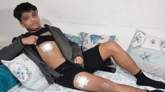 Mesajlaştığı kızın eski sevgilisi ve arkadaşları dehşeti yaşattı! ‘Bıçağı yedi, daha konuşamaz'