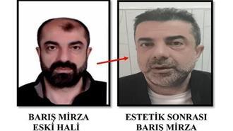 Ameliyat ile yüzünü değiştiren firari 7 yıl sonra yakalandı