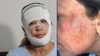 7 bin liralık ‘Prenses cilt bakımı’ kabusu: Oğlum beni görünce 'öcü' diyerek kaçtı