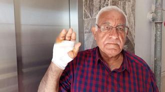 Asansörde korkunç saldırı! Komşusu parmağını ısırarak kopardı: Onu çok severdim, niçin yaptı anlamadım