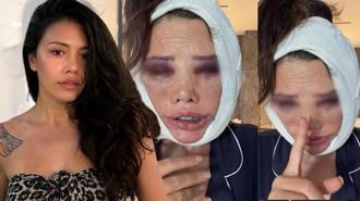 Kore'de yüz nakli olmuştu! Survivor Didem Ceran'dan 'kölelik' çıkışı