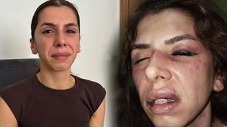 Eşi tarafından 4 saat işkence gördü, boğazına bıçak dayandı