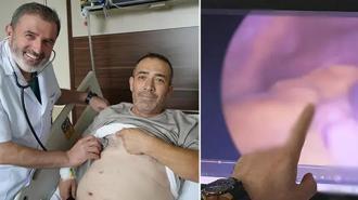 Tüm organları ters yerde, doktorlar bile şaşırıyor