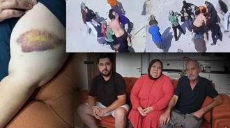 İki ailenin meydan savaşı: Mangal yapıp bize gıcıklık veriyorlar