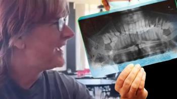 54 yıldır dişlerine 1 kez bile fırça sürmedi! 'Hiç çürüğüm yok'