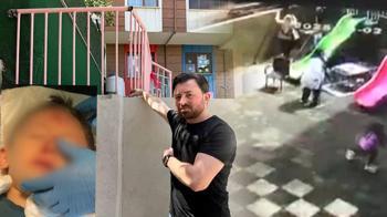 Kreşte skandal! 'Ufak bir kaza' diye aradılar, aile gerçeği öğrendi şoka girdi