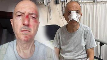 Boşanma aşamasındaki eşinin kardeşi kabusu oldu: Asfalta düştüm