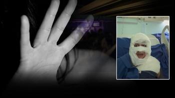 Kadıköy'de eğlence mekanında dehşet: Genç kadını kolonya döküp yaktı