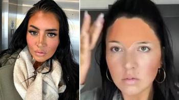 Her gün botoks yaptırdı sandılar! Kırışıklık karşıtı tüyo: 'Saçma değilmiş'