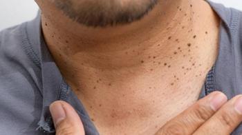 Evde et benlerinden kurtulmak mümkün! Mutfaktaki tek malzeme yetiyor