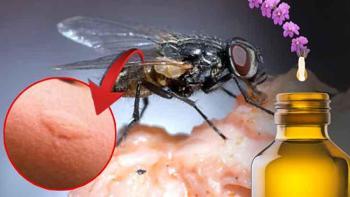 Karasinekleri tek hamlede kovmanın yolu! Kokuları çıkarın: Bir damla yeter