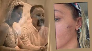 Yıldız Asyalı'dan şoke eden iddia! 'Kocam tarafından darp edildim'