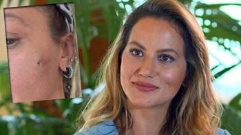 Yıldız Asyalı'dan şoke eden paylaşım! 'Kocam tarafından darp edildim'