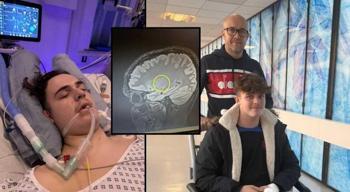 Doktorlar 1 yıldır 'basit bir baş ağrısı' diyordu! Acı gerçek sonradan ortaya çıktı: Tedavisi yok