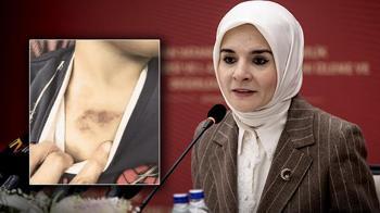 İBB'ye ait kreşte darp ve istismar iddiası! Bakan Göktaş: Maalesef farklı ihbarlar geliyor