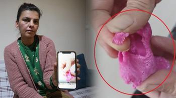 Oyun hamuru çocukların ellerini kan içinde bıraktı: Bu ilk vaka değil