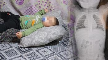 Bebeğin içinde ilerliyordu! 1 yıl boyunca ağladı: Tomografide korkunç gerçek