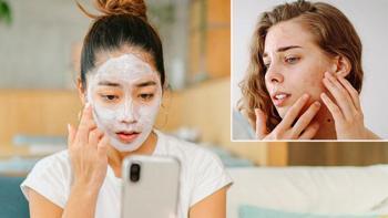 Sosyal medyadaki cilt bakım trendlerine dikkat! Sivilceleri artırıyor