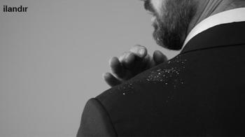 Kepeğe ve Saç Dökülmesine Karşı Şampuan Seçiminde Nelere Dikkat Edilmeli?