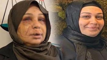 Eşini yaralayan polis memurunun dosyası, ağır cezaya gönderildi: Ben büyük bir aile katliamını önledim.