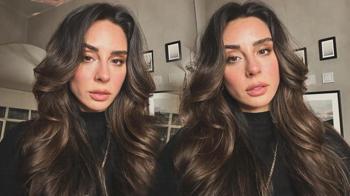 Talihsiz kazada bacağı kırılmıştı! Yasemin Yürük son sağlık durumunu paylaştı