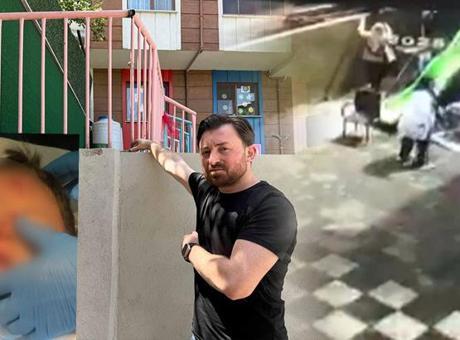 Kreşte skandal olay! 'Ufak bir kaza' diye aradılar, aile gerçeği öğrendi şoka girdi