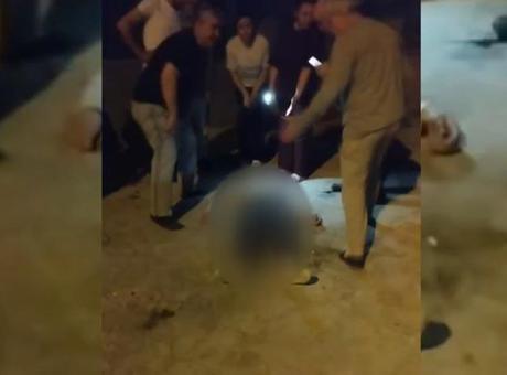 Eski nişanlısının elinde bıçak gören kadın kendisini balkondan attı