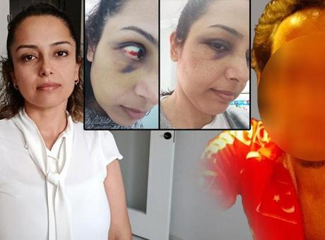 68469017691548ef5737a271 Genç öğretmenin ikinci bahar hayali kabusa döndü! 'Hamileyken dövdü, bebeğimi kaçırdı, aracımı çaldı'