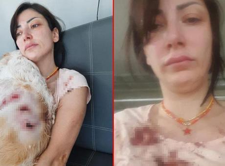 685cead1e9347e6b90df3b0b Genç kadın kanlar içinde kaldı! 'Bacağımın arkasını parçaladılar'