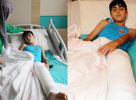 686784a9407805e46c037997 Kolonya şakası dehşete dönüştü: 11 yaşındaki Emir alevler içinde kaldı