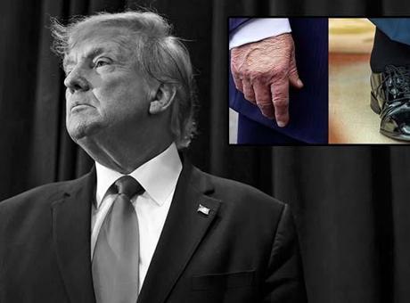 6879e6f8d13a6e6d2d96bff8 GÜNLERDİR KONUŞULUYORDU: ABD BAŞKANI TRUMP'IN GİZEMLİ HASTALIĞI ORTAYA ÇIKTI!
