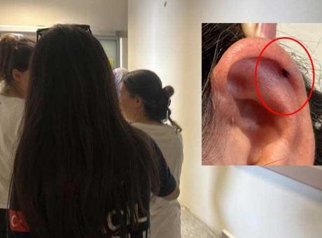 6885f5efa24008c540a88109 Kulağında fark etti, hemen hastaneye koştu