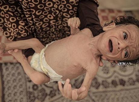 688db263736e83cca7f0ba5e Gazze'de anneler sütten kesildi, bebekler ölümün eşiğinde: Ne mama var ne temiz su!