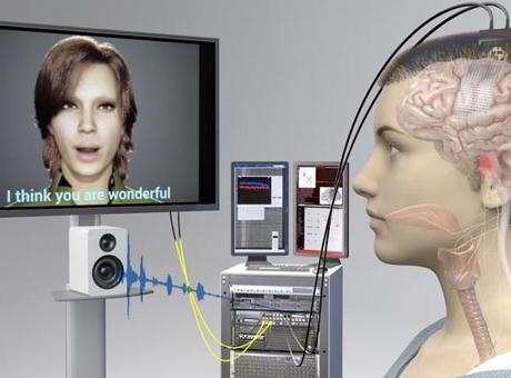 689dea34684dabc55d5e6a8e 18 yıl sonra konuştu: Felçli hastaya yapay zeka destekli beyin implantı yapıldı
