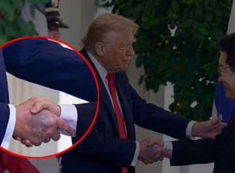68acc6558310db41d5211882 Trump'ın elindeki morluk hakkında Beyaz Saray'dan açıklama