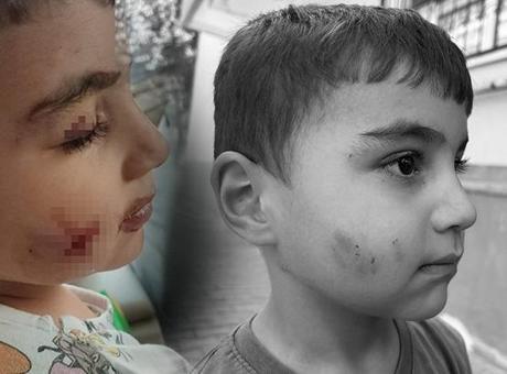 Ankara'da kan donduran olay!: Evde uyuyan çocuğu lağım faresi ısırdı