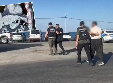 68dc1c3bde7b8a5d209ad280 Polis kıskıvrak yakaladı! Midesinden çıkanlar şaşkına çevirdi