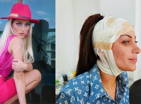 690c72473b681ccda5138355 Barbie'ye benzemek uğruna 27 ameliyat geçirmişti! Sosyal medya fenomeninin gizemli ölümü