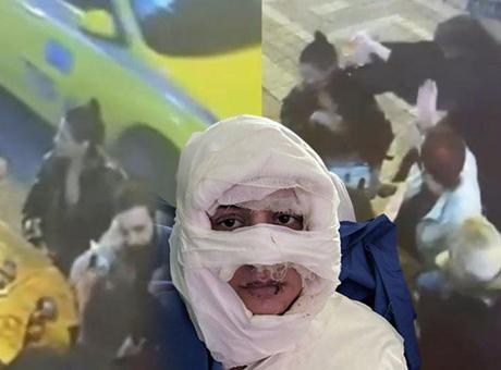 6911ad2736206bb89d50ad11 Kadıköy’de vahşet! Çakmakla yakılan kadına kan donduran mesajlar: 'Kız arkadaşım sizin yüzünüzden hapse girdi...'