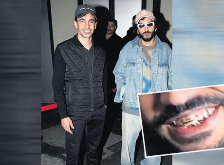 Altın dişleri göz aldı