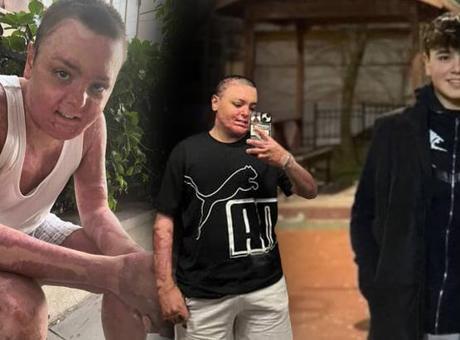 Felaketten mucizeye: 6 ay sonra çok güzel fotoğraflarla mutluluğunu paylaşacak