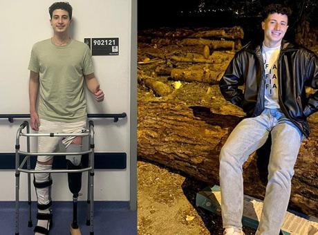 Bacağını kaybeden üniversiteli genç 7 ay sonra ayağa kalktı: Milli takımda olmayı çok isterim